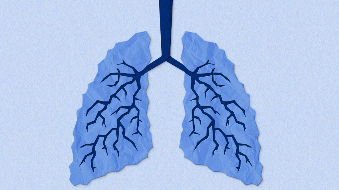 Fibrosis Explained - Lungs