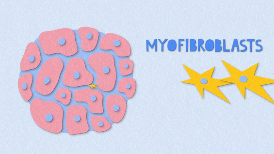 Fibrosis Explained - Myofibroblasts